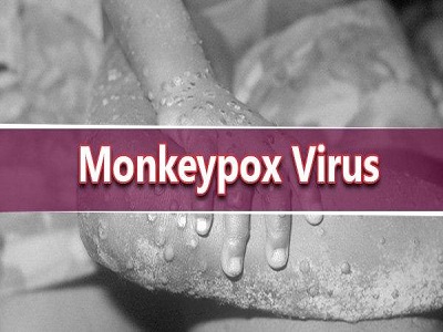 کلیاتی در مورد ویروس آبله میمونی
