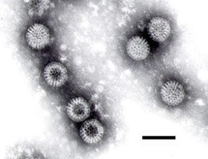 the wheel-like appearance of some of the rotavirus particles