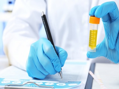 urine test may be able to detect ovarian cancer early